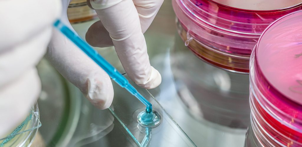 Legionella Pipette and specimen
