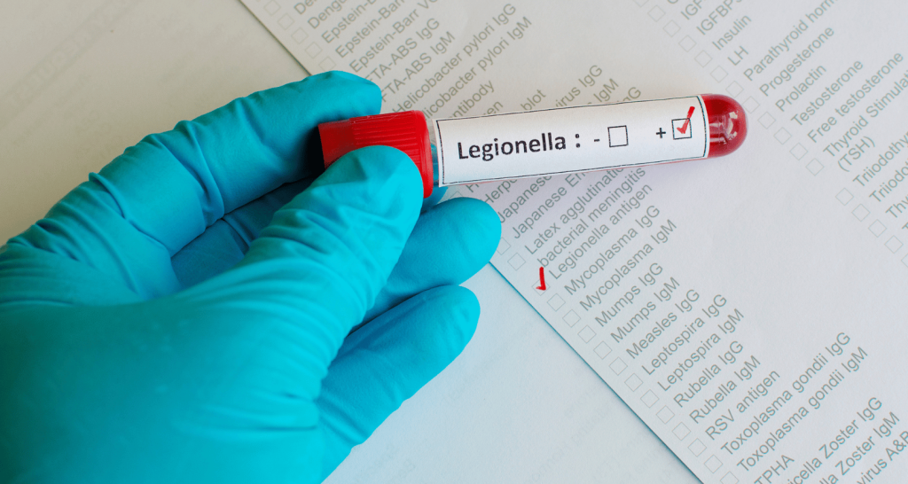 How to Prevent Costly HSE Fines Through Effective Legionella Control